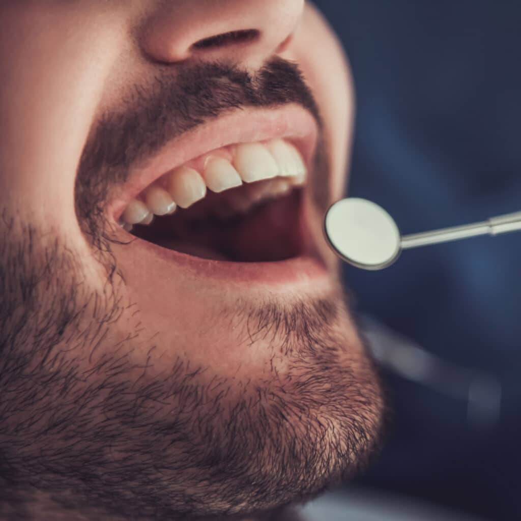 dental exam image